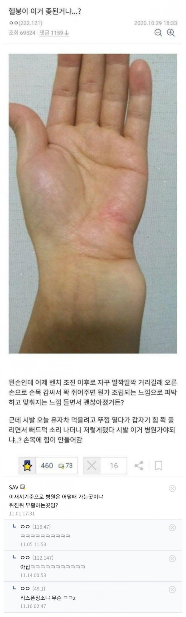 디씨 손목 브레이커를 본 응급의학과 선생님...JPG